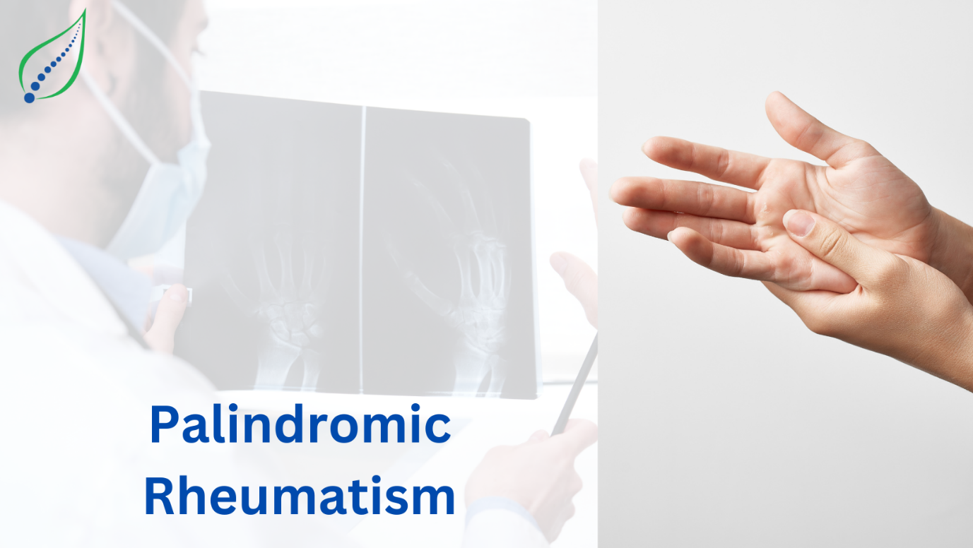 Palindromic Rheumatism